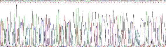 Recombinant Left/Right Determination Factor 2 (LEFTY2)