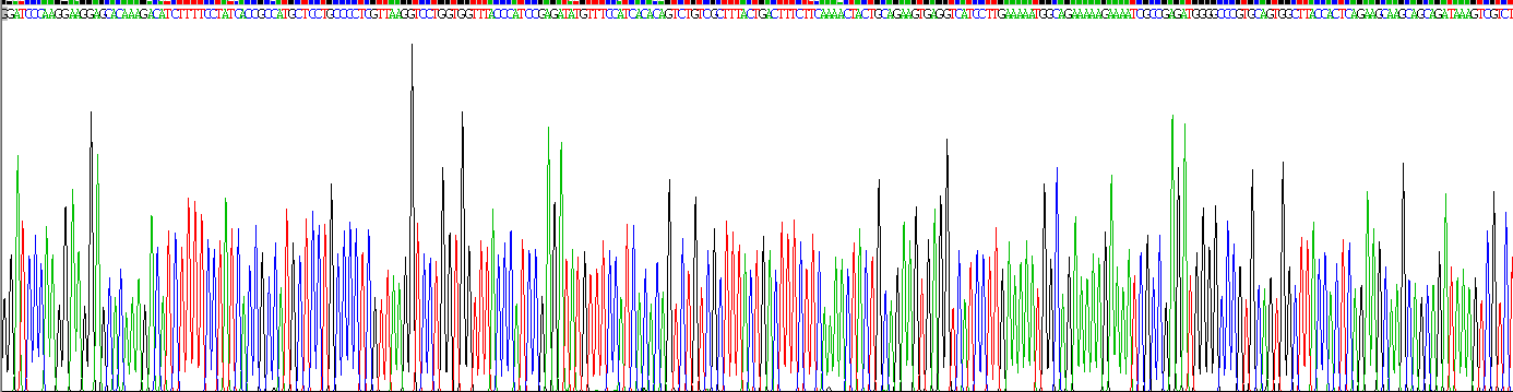 Recombinant Interleukin 17 Receptor B (IL17RB)