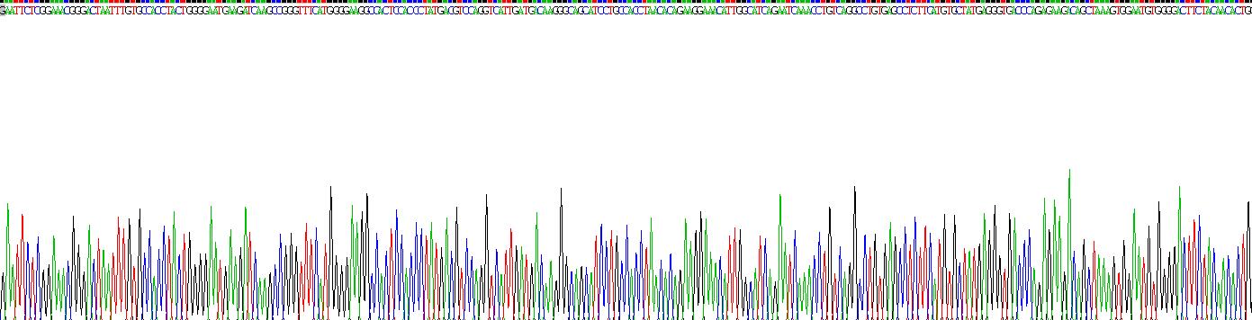 Recombinant Acyl Coenzyme A Synthetase Medium Chain Family, Member 1 (ACSM1)