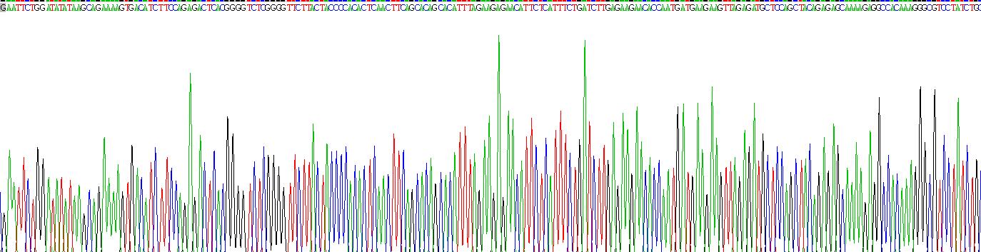 Recombinant Phospholipase A2 Receptor 1 (PLA2R1)