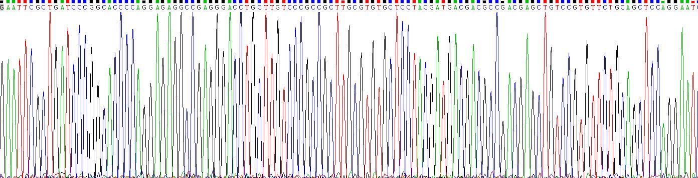 Recombinant Insulin Like Growth Factor Binding Protein, Acid Labile Subunit (IGFALS)