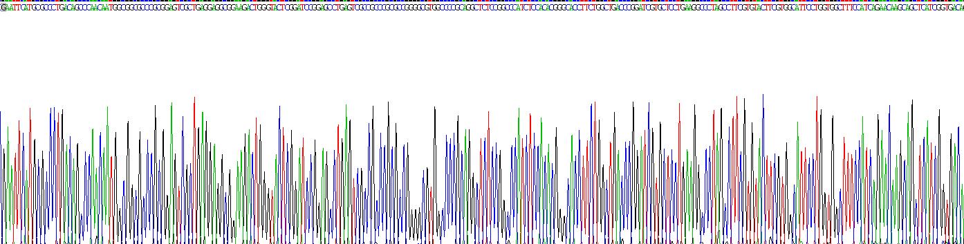 Recombinant Lipase Maturation Factor 1 (LMF1)