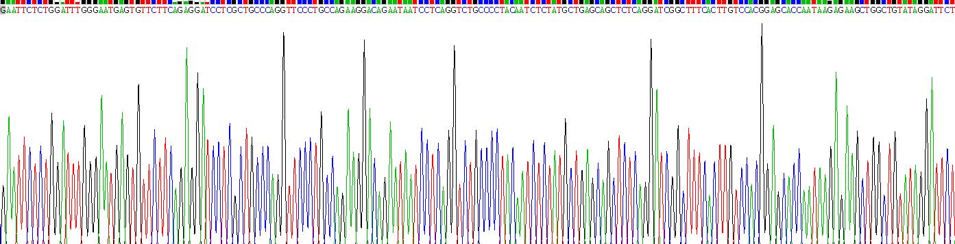 Recombinant Homogentisate-1,2-Dioxygenase (HGD)