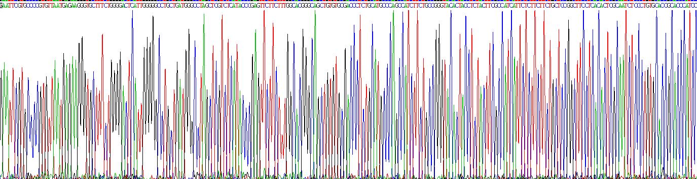 Recombinant Sodium/Glucose Cotransporter 2 (SGLT2)