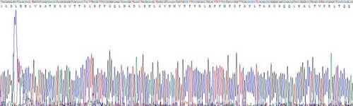 Recombinant Tubulin Beta 3 (TUBb3)