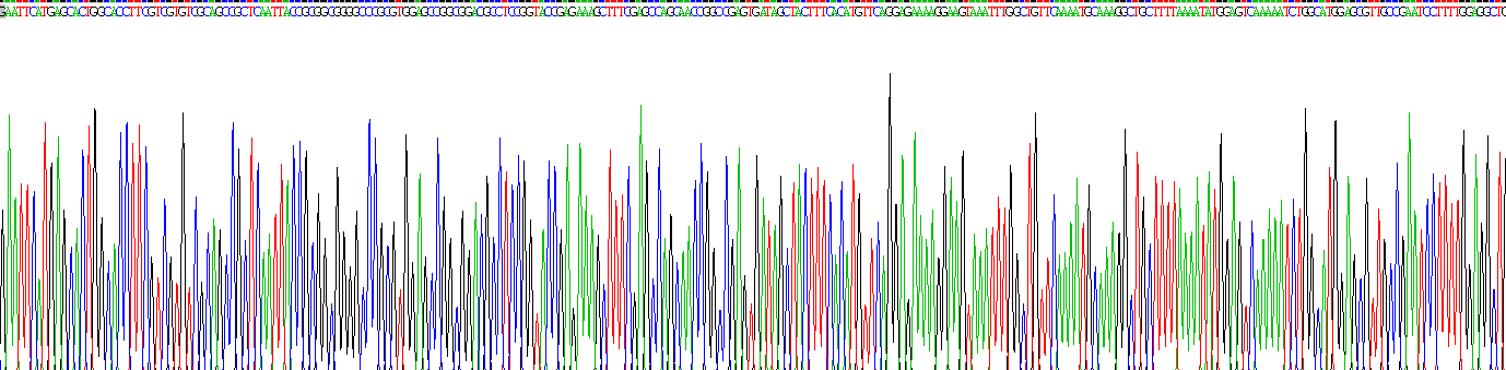 Recombinant Aldehyde Dehydrogenase 9 Family, Member A1 (ALDH9A1)