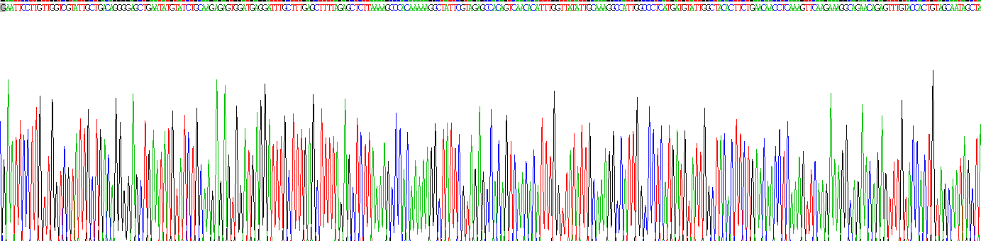 Recombinant Splicing Factor 3B Subunit 1 (SF3B1)