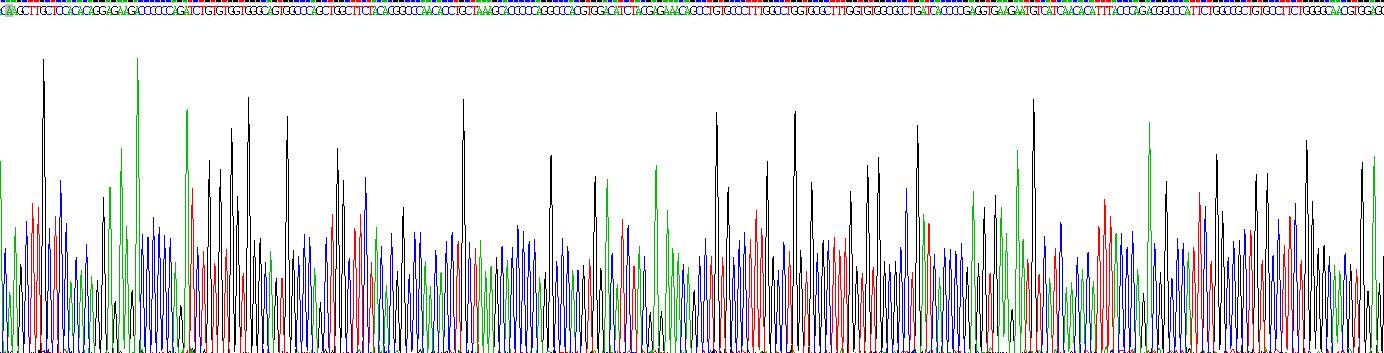 Recombinant Ferredoxin Reductase (FDXR)