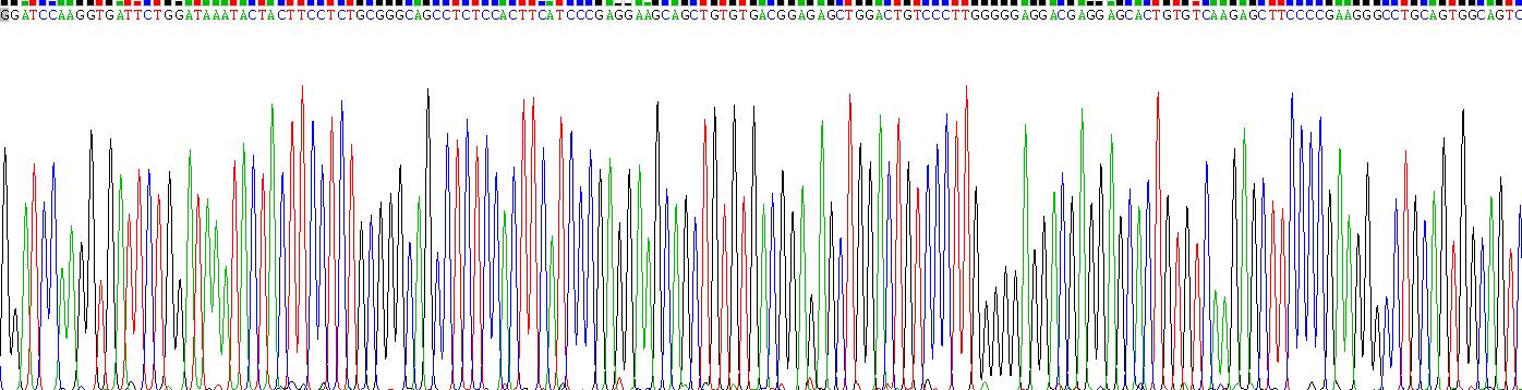 Recombinant Transmembrane Protease, Serine 4 (TMPRSS4)