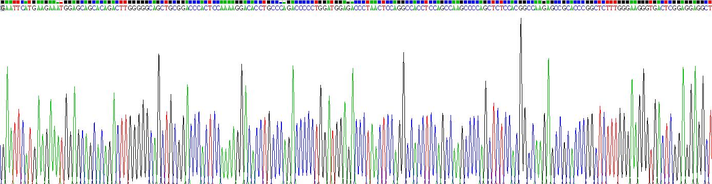 Recombinant Transient Receptor Potential Cation Channel Subfamily V, Member 1 (TRPV1)