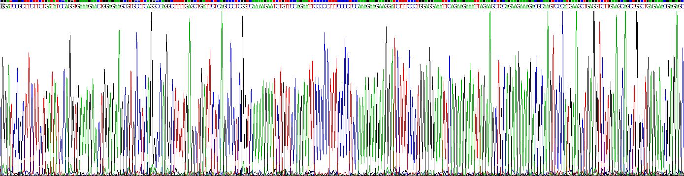 Recombinant Statherin (STATH)