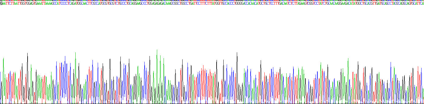 Recombinant Dopa Decarboxylase (DDC)