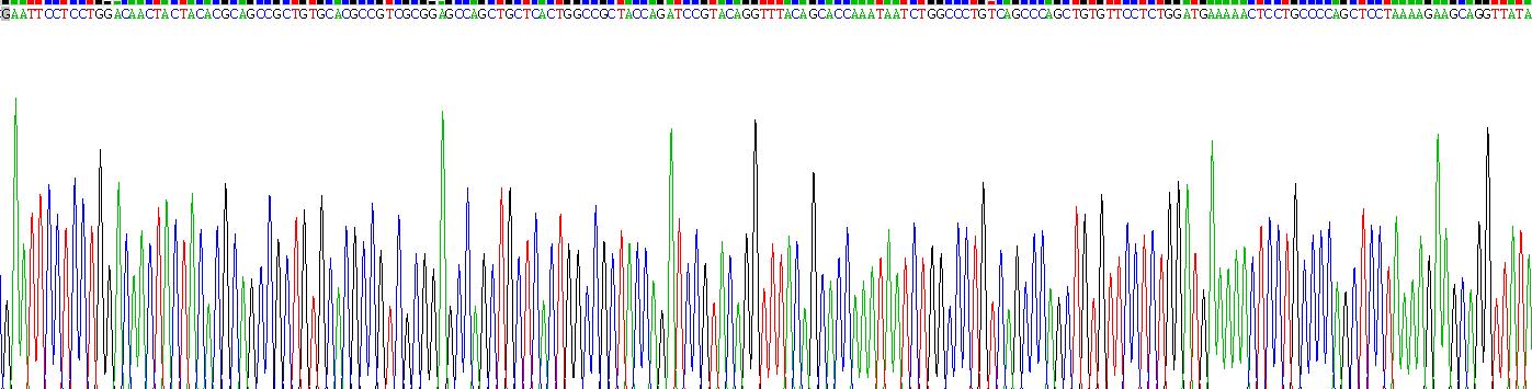 Recombinant Arylsulfatase B (ARSB)