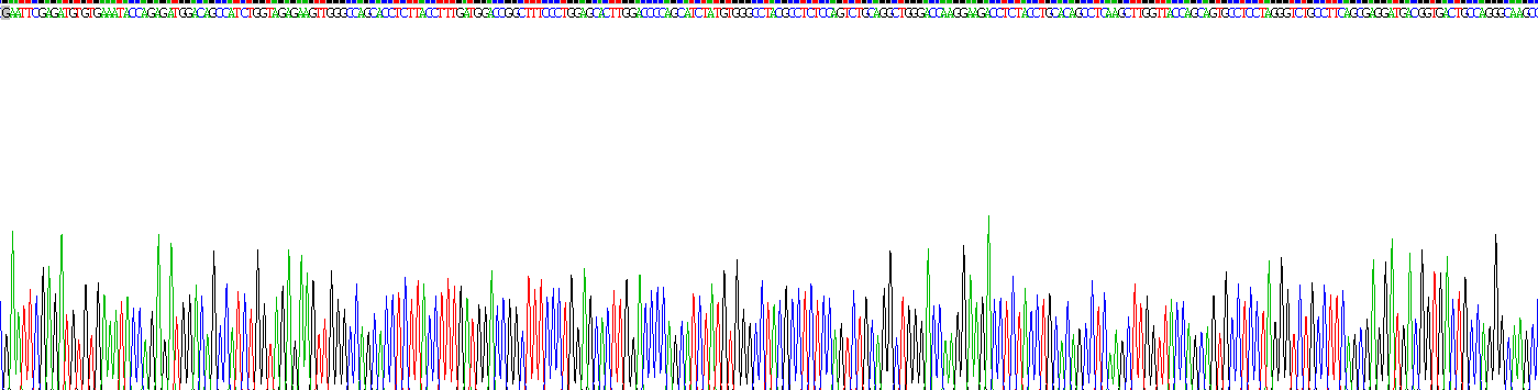 Recombinant Transcobalamin II, Macrocytic Anemia (TCN2)