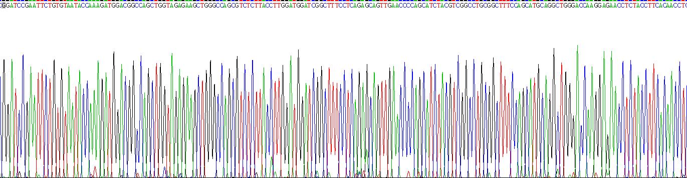 Recombinant Transcobalamin II, Macrocytic Anemia (TCN2)