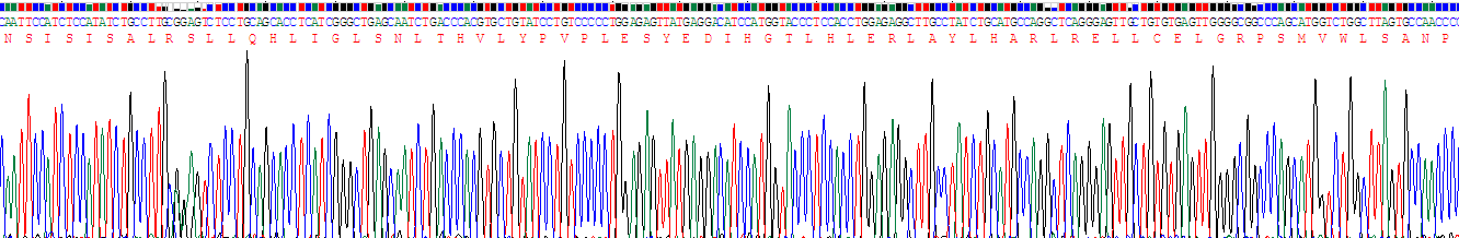 Recombinant Preferentially Expressed Antigen In Melanoma (PRAME)