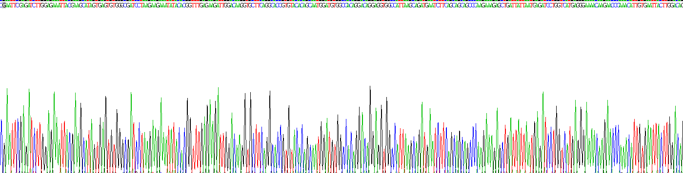 Recombinant p21 Protein Activated Kinase 1 (PAK1)