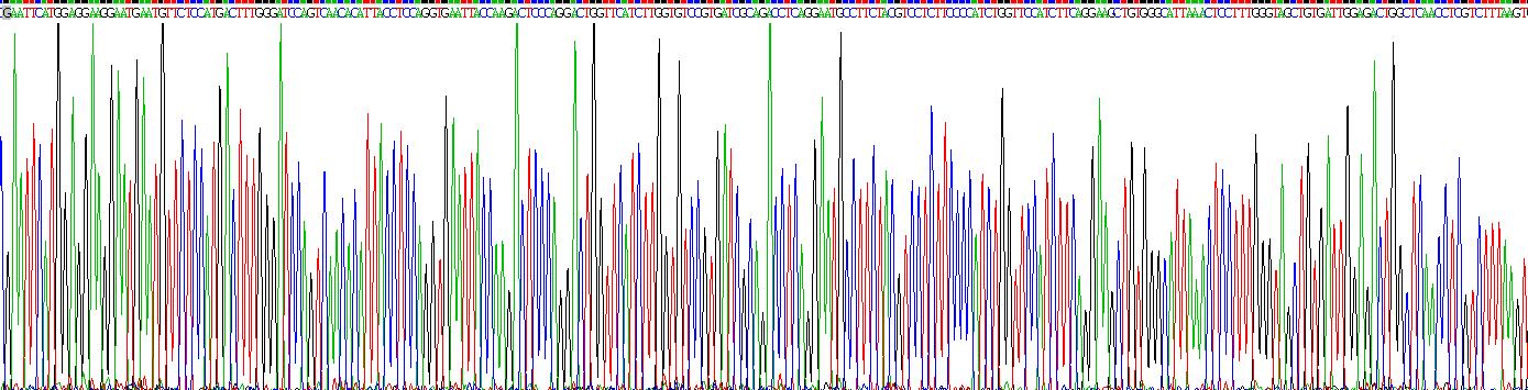 Recombinant Glucose-6-Phosphatase, Catalytic (G6PC)