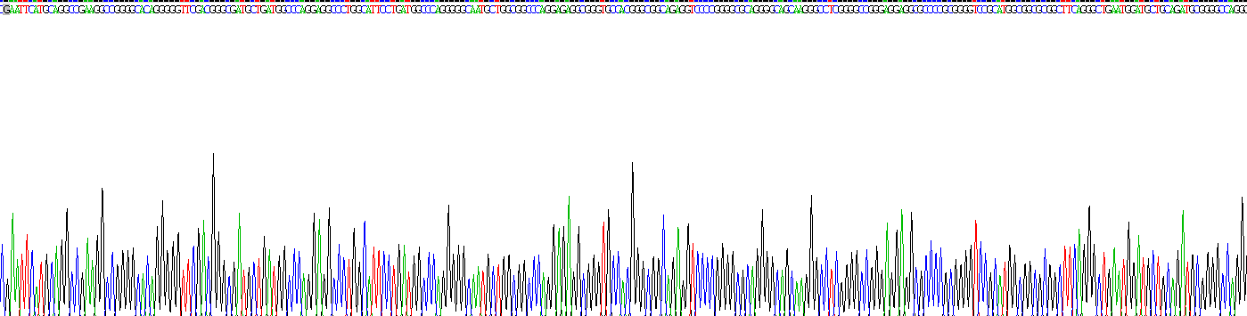 Recombinant Cancer/Testis Antigen 1B (CTAG1B)