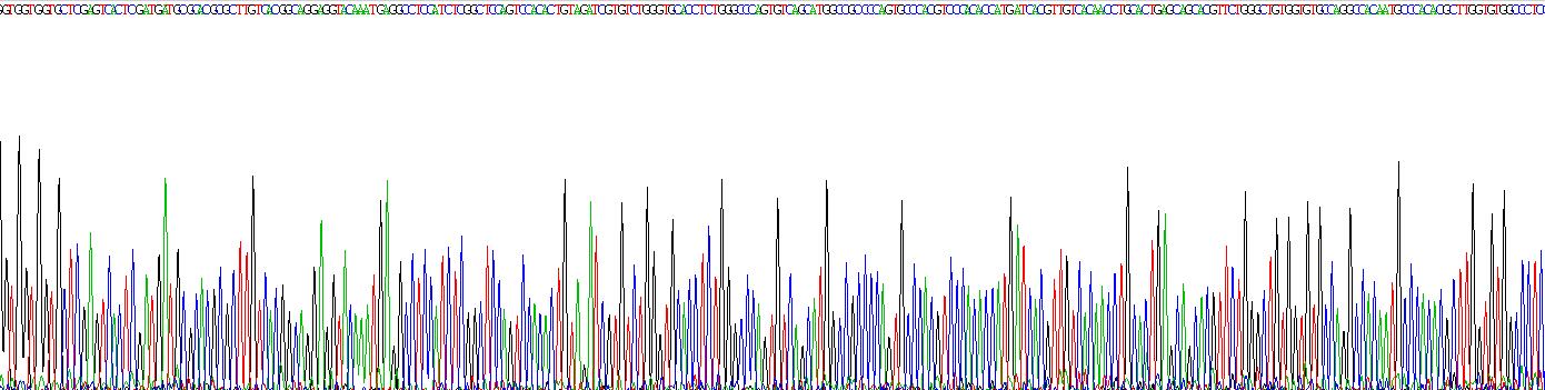 Recombinant Coronin 1A (CORO1A)