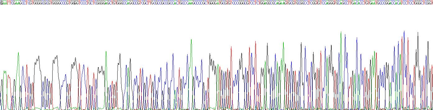 Recombinant Cartilage Intermediate Layer Protein 2 (CILP2)