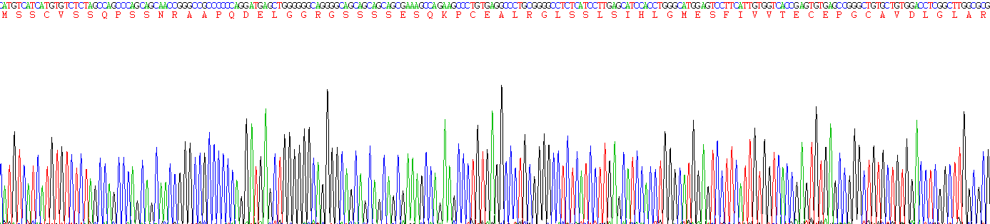 Recombinant Calcium/Calmodulin Dependent Protein Kinase Kinase 2 (CAMKK2)