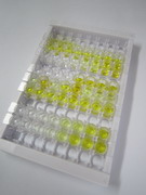 ELISA Kit for Tissue Inhibitors Of Metalloproteinase 3 (TIMP3)