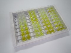 ELISA Kit for Glucosidase Alpha, Acid (GaA)