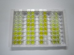 ELISA Kit for Alanine Aminotransferase (ALT)