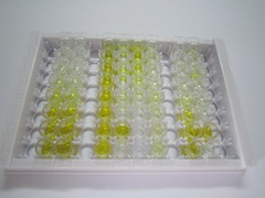 ELISA Kit for Pyruvate kinase isozymes R/L (PKLR)