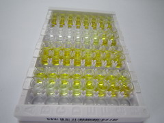 ELISA Kit for Vascular Cell Adhesion Molecule 1 (VCAM1)