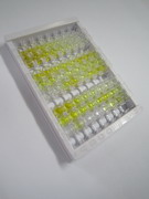 ELISA Kit for Tissue Inhibitors Of Metalloproteinase 1 (TIMP1)