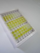 ELISA Kit for Procollagen I N-Terminal Propeptide (PINP)