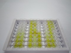 ELISA Kit for Corticosteroid Binding Globulin (CBG)