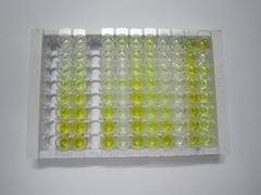 ELISA Kit for Androgen Receptor (AR)