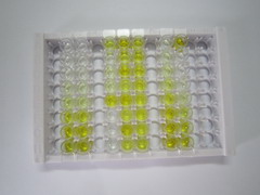 ELISA Kit for Lipase, Hormone Sensitive (LIPE)