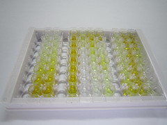 ELISA Kit for Lipocalin 1 (LCN1)