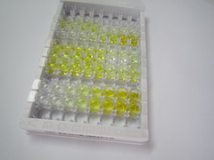 ELISA Kit for Fascin (FSCN)