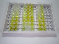 ELISA Kit for Prekallikrein (PK)