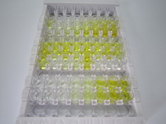 ELISA Kit for Uridine Phosphorylase 1 (UPP1)