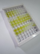 ELISA Kit for Nuclear Factor Kappa B (NFkB)