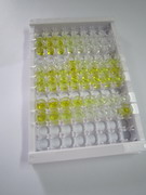 ELISA Kit for Nuclear Factor Kappa B (NFkB)