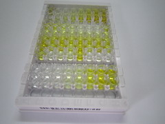 ELISA Kit for Beta-1,4-Galactosyltransferase 1 (b4GALT1)