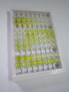 ELISA Kit for Mannose Associated Serine Protease 1 (MASP1)