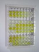 ELISA Kit for Desmoplakin (DSP)