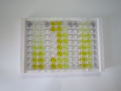 ELISA Kit for Fatty Acid Synthase (FASN)