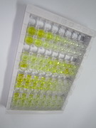 ELISA Kit for Microseminoprotein Beta (MSMb)