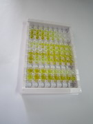 ELISA Kit for Rhodopsin (RHO)