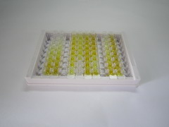 ELISA Kit for Sclerostin (SOST)