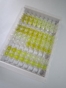 ELISA Kit for Sclerostin (SOST)